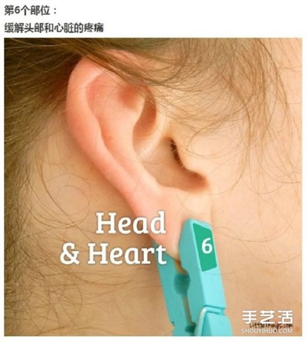 A simple emergency method to relieve pain in daily life only uses a clip! 