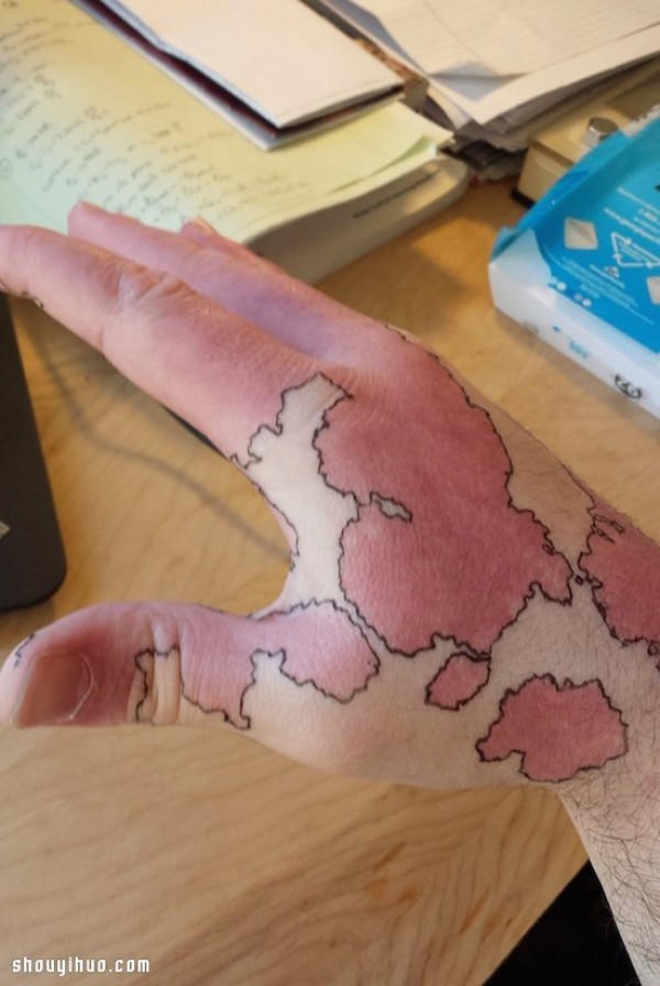 Inspirational Birthmark Brother, draw a world map of your own! 