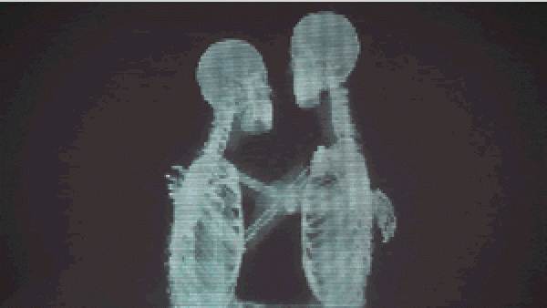 Take away external prejudices and witness true love under X-rays! 