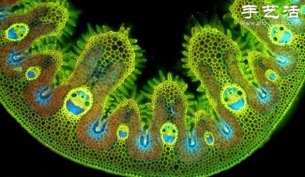 Slices of marijuana under the microscope, suddenly I seem to understand. . . 