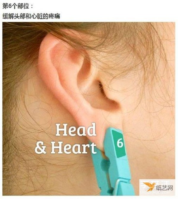 A simple emergency method for pain relief in daily life, just use a clip