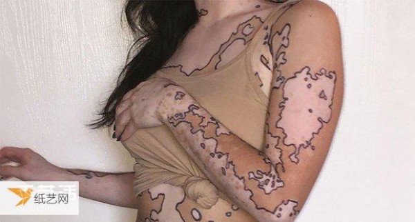 A mark that makes people proud! Girl with vitiligo gains confidence with body painting