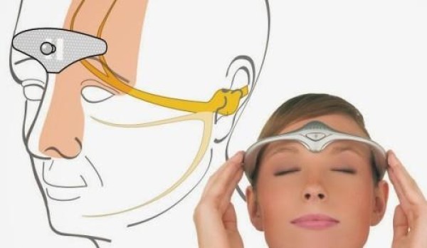 Effectively relieve migraines—Cefaly smart pulse headband