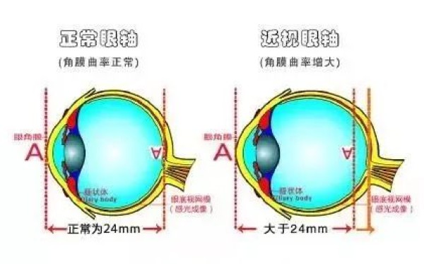 The island nation launches electronic zoom glasses that allow you to see distant and near objects clearly at the same time