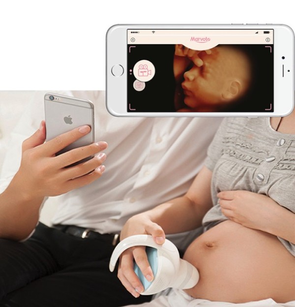 Marvoto is a product that allows pregnant women to take photos of their babies at any time