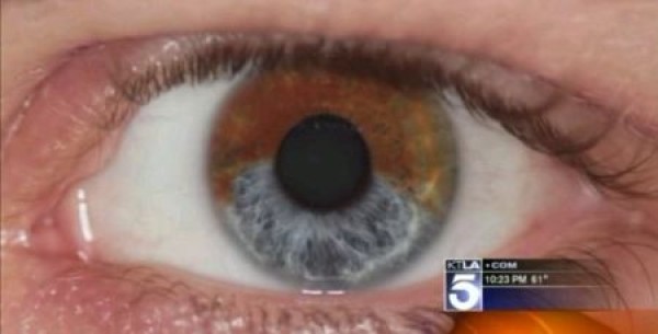 Amazing eye color changing technology