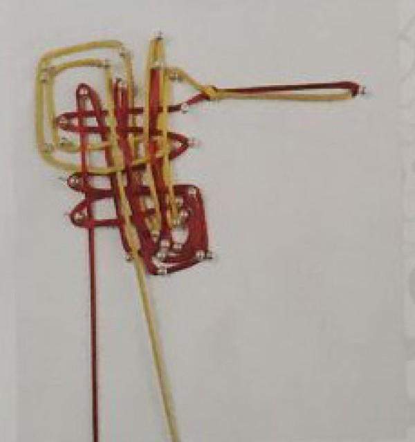 Diagrammatic method of compound wing plate long knot